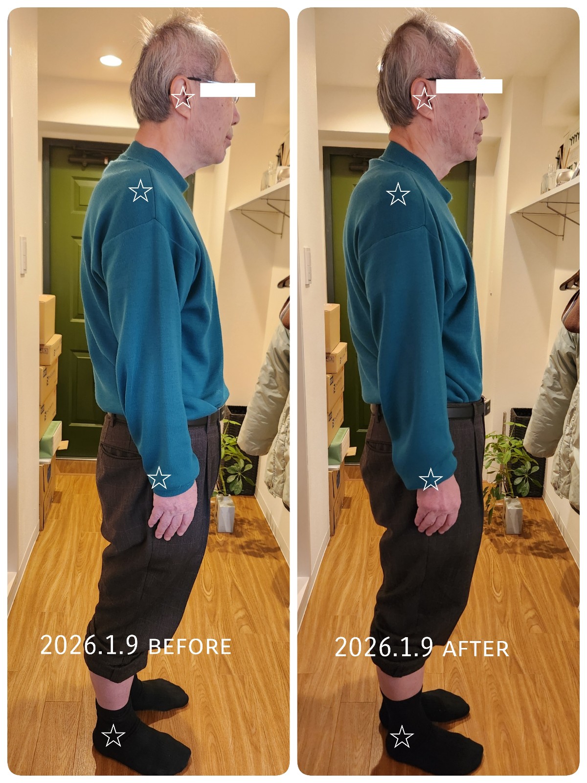 20年治らなかった腰痛の症例分析